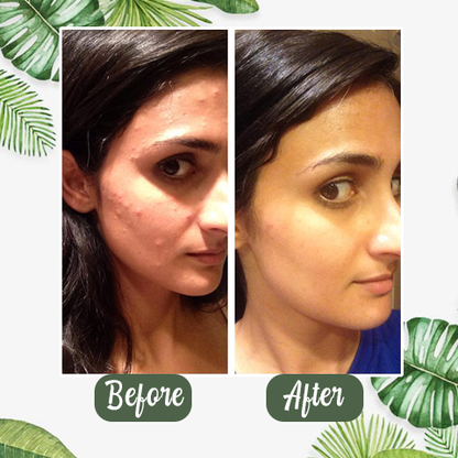 lumovelle™  100% Natural Green Tea Deep Cleanse Mask