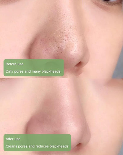 lumovelle™  100% Natural Green Tea Deep Cleanse Mask